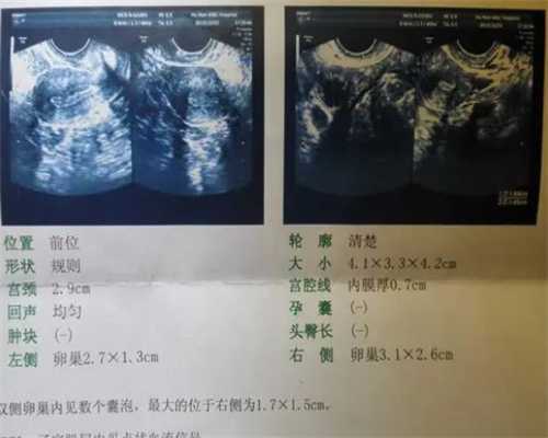 浙江医院代孕手术,同性恋做出的试管婴儿是否受法律保护_供卵试管二代流产两