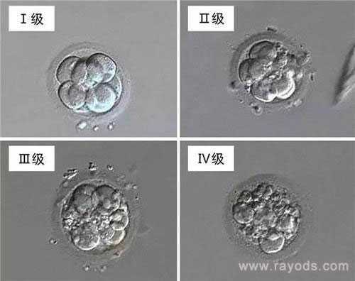 浙江哪里代生比较好,试管婴儿移植手术之前医生是怎样挑选优质胚胎的？_浙江