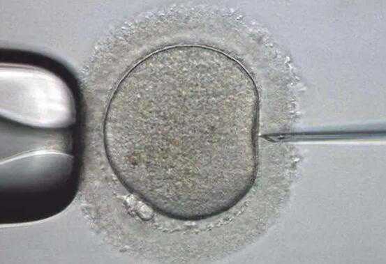 子宫切除会生育吗_胎停 染色体异常_什么是试管婴儿？试管婴儿的历史介绍
